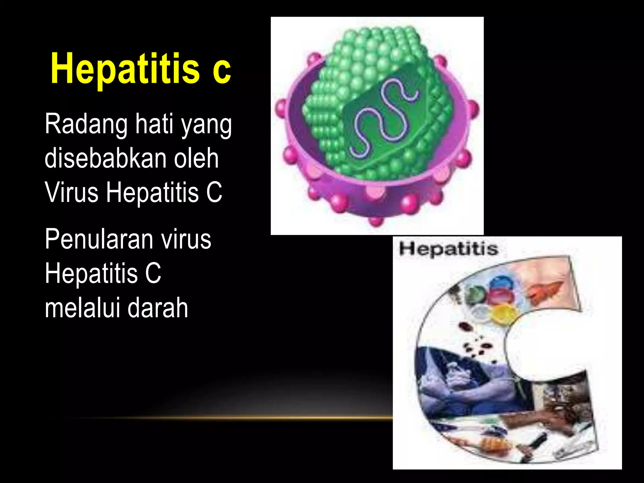 Hepatitis c
Radang hati yang
disebabkan oleh
Virus Hepatitis C
Penularan virus
Hepatitis C
melalui darah
 