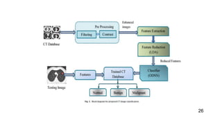 Optimal Deep Learning model for Classification of Lung Cancer | PPT