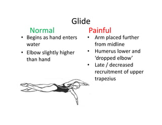 Glide
• Begins as hand enters
water
• Elbow slightly higher
than hand
Normal Painful
• Arm placed further
from midline
• Humerus lower and
‘dropped elbow’
• Late / decreased
recruitment of upper
trapezius
 