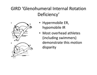 GIRD ‘Glenohumeral Internal Rotation
Deficiency’
• Hypermobile ER,
hypomobile IR
• Most overhead athletes
(including swimmers)
demonstrate this motion
disparity
 