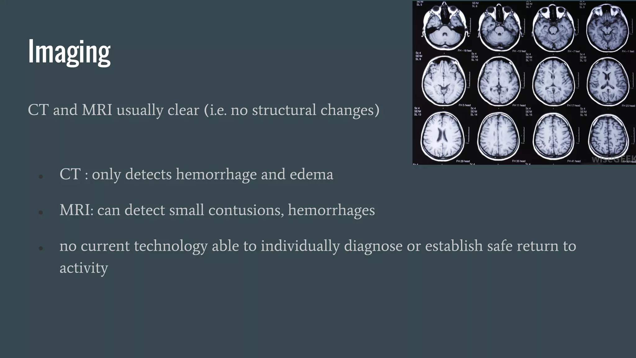 Imaging
CT and MRI usually clear (i.e. no structural changes)
● CT : only detects hemorrhage and edema
● MRI: can detect small contusions, hemorrhages
● no current technology able to individually diagnose or establish safe return to
activity
 