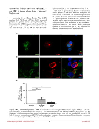 Oncotarget7www.impactjournals.com/oncotarget
Identification of direct interaction between PAI-1
and LRP1 in human glioma tissue by proximity
ligation assay
According to the Human Protein Atlas (HPA)
database, both PAI-1 and LRP1 are highly expressed
proteins in glioma tissues (www.proteinatlas.org).
Considering that LRP1 is expressed on other cell types
in glioma in addition to MCs, we wanted to ascertain in
vivo interaction of LRP1 and PAI-1in MCs. Proximity
ligation assay (PLA) was used to detect binding of PAI-
1 with LRP1 in glioma tissue. Positive co-localization
signals (Figure 5A-5B) were abundant throughout the
tumor tissue. To ascertain MC distribution/presence in
the vicinity, the tissues were counter-stained with human
MC specific protease, tryptase (hTPS) (Figure 5A-5B).
We were able to detect that PAI-1 indeed binds to LRP1
in human glioma tissue attributing, to a certain extent,
these interactions with LRP1 on MCs. Hence, these data
elucidate an in vivo attractant role for PAI-1 leading to the
observed high accumulation of MCs in glioma.
Figure 4: MCs constitutively express LRP1. (A) Immunofluorescence staining for LRP1 and human tryptase (hTPS) in LAD2 cells.
Scale bar = 25 µM. (B) Immunofluorescence staining for LRP1 and human tryptase (hTPS) in human GBM tissue. Scale bar = 25 µM. (C)
Blocking of LRP1 by receptor associated protein (RAP) attenuates the migration of MCs. LAD2 cells were treated with 25 µM and 50 µM
RAP, 30 min prior to migration assay. U2987MG-conditioned medium was used as the chemoattractant. Three independent experiments
were performed with triplicates. The error bars represent the SD. *** p < 0.001.
 