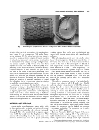 include either surgical reoperation with cardiopulmo-
nary bypass [1], or percutaneous PVR under ﬂuoro-
scopic guidance [2]. In animal experimental models,
research is underway to investigate off-pump insertion
of a functional pulmonary valve, using a combination
of minimal invasive surgical technique and percutane-
ous release systems [3–6], which have also been
reported in scant case reports in humans [7,8]. Inde-
pendently of the mode of insertion, the extant biologi-
cal valvar implants all have a limited life span, so that
the grail in the search of the ideal pulmonary valve
replacement remains to be found. Furthermore, percuta-
neous valve insertion has inherent limitations due to
the size of the device, the vessels and the patients, ren-
dering new solutions to approach mandatory to expand
the indications for an ever-growing patient population
in need of a competent pulmonary valve.
Attempting to overcome the drawbacks inherent to
the current systems, we describe the ﬁrst time implan-
tation of a decellularized biological valve made from
an equine jugular vein, sutured into a self-expanding
nitinol stent with a sinus portion using a hydraulic
stent-delivery and release system, and describe our ex-
perience with regards to minimally invasive surgical
insertion of this prosthesis in a sheep survival model.
MATERIAL AND METHODS
A new equine stented pulmonary valve, with a built-
in sinus portion, and a hydraulic mechanism release de-
vice to allow transventricular valve release were newly
developed. The valve consisted of an equine jugular
vein, freshly harvested from the slaughterhouse. After
removal of surrounding tissue, the valve areas were
identiﬁed and the vein was cut in pieces containing
working valves. The grafts were decellularized and
sutured with running sutures into a self-expanding niti-
nol stent.
The self-expanding stent is laser-cut out of a nitinol
tube, with a sinus portion ﬁtting to the natural shape of
the valve area. Two sizes of stents were used: the di-
ameter of the stent at the tubular part was 22 and 25
mm, respectively, and the sinus portion had a maxi-
mum diameter of 25 and 27.5 mm, respectively. The
length of the stent in its expanded shape was 29 mm.
Thanks to the sinus portion of the stent, the valve is
able to work in its natural manner to reduce or elimi-
nate the so-called ‘‘hammock effect.’’ The stent has
eyes at the proximal end to allow for a controlled
release (Fig. 1).
The delivery instrument consists of a stent chamber
with an outer diameter of 25 F and a very ﬂexible
delivery catheter with a diameter of 6 F. The stent con-
taining the valve is crimped down to the necessary di-
ameter and loaded into the stent chamber prior to
delivery. A silicone tip is ﬁxed to the distal end of the
delivery instrument to ease insertion of the instrument
through the myocardium, and reduce the risk of injury
to the vessels (Fig. 2). At the distal end of the instru-
ment, a luer lock connection allows safe and leak-proof
hydraulic connection of a standard 5 ml syringe. The
stent release is carried out by loading hydraulic pres-
sure on the stent chamber using sterile saline. During
release, the instrument can be locked into position,
which eases positioning. The instrument can be deliv-
ered over a 0.03500
guide wire.
Between November 2009 and August 2010, seven
Gotlandsfar lambs weighing 34–56 kg underwent a
right minithoracotomy for surgical insertion of the
stented equine valves, through direct right ventricular
Fig. 1. Stented equine graft displaying the sinus conﬁguration of the stent and the tricuspid leaﬂets.
Equine Stented Pulmonary Valve Insertion 655
Catheterization and Cardiovascular Interventions DOI 10.1002/ccd.
Published on behalf of The Society for Cardiovascular Angiography and Interventions (SCAI).
 