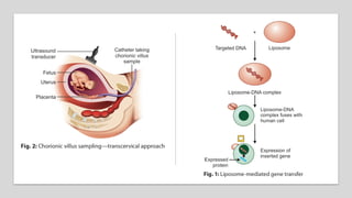 Features of clinical genetics by dr yogesh | PDF