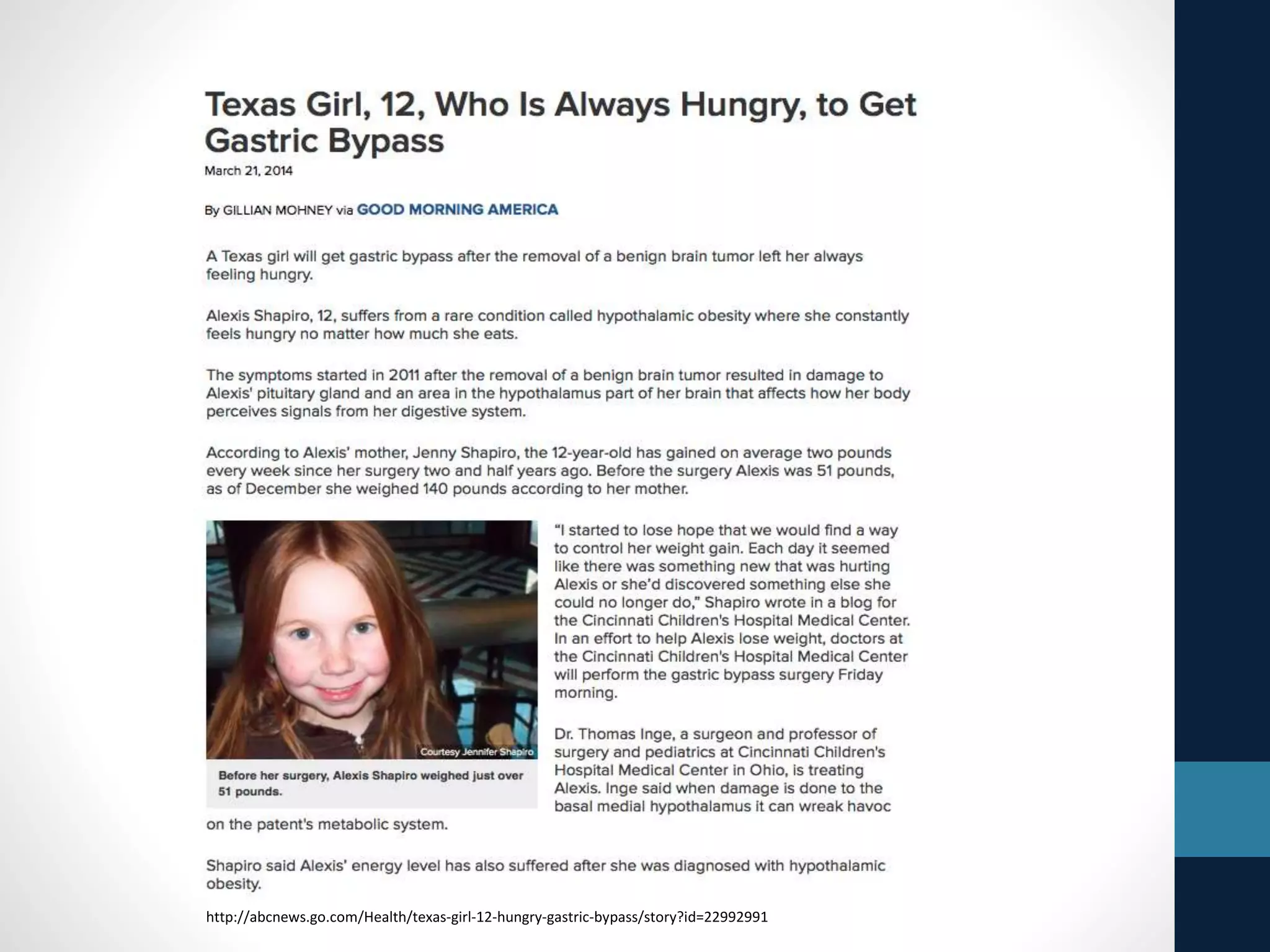 http://abcnews.go.com/Health/texas-girl-12-hungry-gastric-bypass/story?id=22992991
 