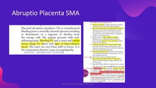 Abruptio Placenta SMA
Shahriar's Medical Academy AMC course
 