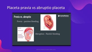 Placeta pravia vs abruptio placeta
Shahriar's Medical Academy AMC course
 