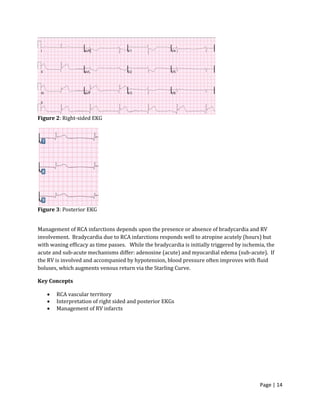 Page | 14
Figure 2: Right-sided EKG
Figure 3: Posterior EKG
Management of RCA infarctions depends upon the presence or absence of bradycardia and RV
involvement. Bradycardia due to RCA infarctions responds well to atropine acutely (hours) but
with waning efficacy as time passes. While the bradycardia is initially triggered by ischemia, the
acute and sub-acute mechanisms differ: adenosine (acute) and myocardial edema (sub-acute). If
the RV is involved and accompanied by hypotension, blood pressure often improves with fluid
boluses, which augments venous return via the Starling Curve.
Key Concepts
 RCA vascular territory
 Interpretation of right sided and posterior EKGs
 Management of RV infarcts
 