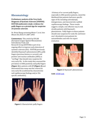 Page | 5
Rheumatology
Preliminary analysis of the Very Early
Diagnosis of Systemic Sclerosis (VEDOSS)
EUSTAR multicentre study: evidence for
puffy fingers as a pivotal sign for suspicion
of systemic sclerosis
Dr. Brian Skaug reviewing Minier T, et al. Ann
Rheum Dis 2014;73: 2087–2093
Commentary: This article by EULAR
(European League Against Rheumatism)
Scleroderma Trials and
Research Group (EUSTAR) is part of an
ongoing effort to improve early detection of
systemic sclerosis (SSc). EUSTAR previously
identified Raynaud’s phenomenon (RP), puffy
fingers (previous history or current), and
positive anti-nuclear antibodies (ANA) as
“red flags” that should raise suspicion for
very early SSc. In this study they assessed the
prevalence of ANA positivity and puffy fingers
(Figure 1) in patients with RP (Figure 2) and
determined how many met the criteria for
very early SSc (confirmed by characteristic
nail capillaroscopy findings and/or SSc-
specific antibodies).
Figure 1: Characteristic puffy fingers
A history of or current puffy fingers,
especially in ANA-positive patients, raised the
likelihood that patients had more specific
signs of SSc including sclerodactyly,
telangiectases, and characteristic nailfold
capillaroscopy findings. These results
suggest a simple, cost-effective way to risk
stratify patients with Raynaud’s
phenomenon. Puffy fingers in these patients
should raise suspicion for early SSc and lower
one’s threshold to test patients for
autoantibodies and refer for expert
evaluation
Figure 2: Raynaud’s phenomenon
Link: UTSW Link
 