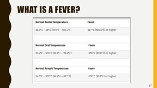 WHAT IS A FEVER?
17
 