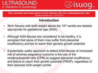 Introduction
• Term fetuses with birth weight above the 10th centile are labeled
appropriate for gestational age (AGA)
• A...