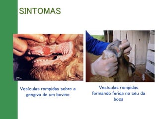 Vesículas rompidas sobre a
gengiva de um bovino
Vesículas rompidas
formando ferida no céu da
boca
SINTOMAS
 