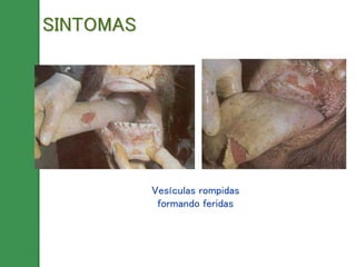 Vesículas rompidas
formando feridas
SINTOMAS
 