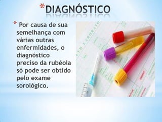 *
* Por causa de sua

semelhança com
várias outras
enfermidades, o
diagnóstico
preciso da rubéola
só pode ser obtido
pelo exame
sorológico.

 