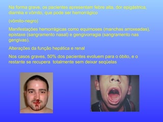 Na forma grave, os pacientes apresentam febre alta, dor epigástrica,
diarréia e vômito, que pode ser hemorrágico
(vômito-negro)
Manifestações hemorrágicas como equimoses (manchas arroxeadas),
epistaxe (sangramento nasal) e gengivorragia (sangramento nas
gengivas).
Alterações da função hepática e renal
Nos casos graves, 50% dos pacientes evoluem para o óbito, e o
restante se recupera totalmente sem deixar seqüelas
 