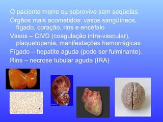 O paciente morre ou sobrevive sem seqüelas
Órgãos mais acometidos: vasos sangüíneos,
fígado, coração, rins e encéfalo
Vasos – CIVD (coagulação intra-vascular),
plaquetopenia, manifestações hemorrágicas
Fígado – hepatite aguda (pode ser fulminante).
Rins – necrose tubular aguda (IRA)
 