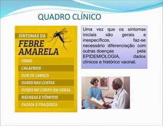 Uma vez que os sintomas
iniciais são gerais e
inespecíficos, faz-se
necessário diferenciação com
outras doenças pela
EPIDEMIOLOGIA, dados
clínicos e histórico vacinal.
Uma vez que os sintomas
iniciais são gerais e
inespecíficos, faz-se
necessário diferenciação com
outras doenças
EPIDEMIOLOGIA,
pela
dados
clínicos e histórico vacinal.
QUADRO CLÍNICO
 
