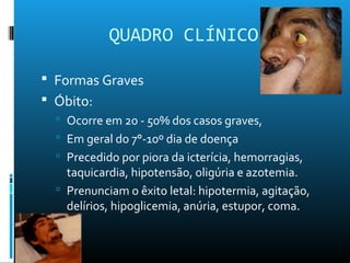 QUADRO CLÍNICO
 Formas Graves
 Óbito:
 Ocorre em 20 - 50% dos casos graves,
 Em geral do 7°-10º dia de doença
 Precedido por piora da icterícia, hemorragias,
taquicardia, hipotensão, oligúria e azotemia.
 Prenunciam o êxito letal: hipotermia, agitação,
delírios, hipoglicemia, anúria, estupor, coma.
 