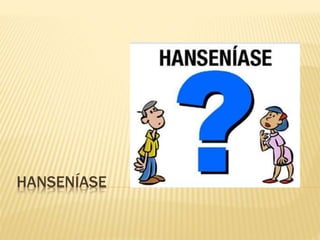 HANSENÍASE 
 