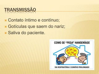 TRANSMISSÃO 
 Contato íntimo e contínuo; 
 Gotículas que saem do nariz; 
 Saliva do paciente. 
 