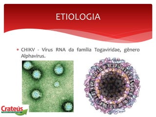  CHIKV - Vírus RNA da família Togaviridae, gênero
Alphavirus.
ETIOLOGIA
 