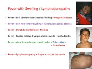 Fever with Swelling / Lymphadenopathy
• Fever + soft tender subcutaneous swelling = Pyogenic Abscess
• Fever + soft non-tender swelling = Tuberculous (cold) abscess
• Fever + Parotid enlargement = Mumps
• Fever + tender enlarged lymph nodes = Acute lymphadenitis
• Fever + chronic non-tender lymph nodes = Tuberculosis
= Lymphoma
• Fever + lymphadenopathy + Purpura = Acute Leukemia
 