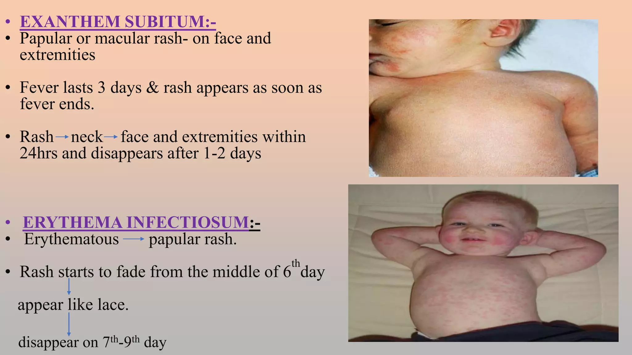 FEBRILE ILLNESS WITH SKIN RASHES.pptx
