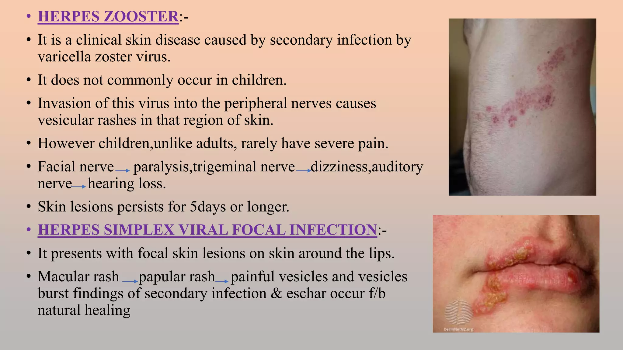 Nervous Skin Rash FEBRILE ILLNESS WITH SKIN RASHES.pptx