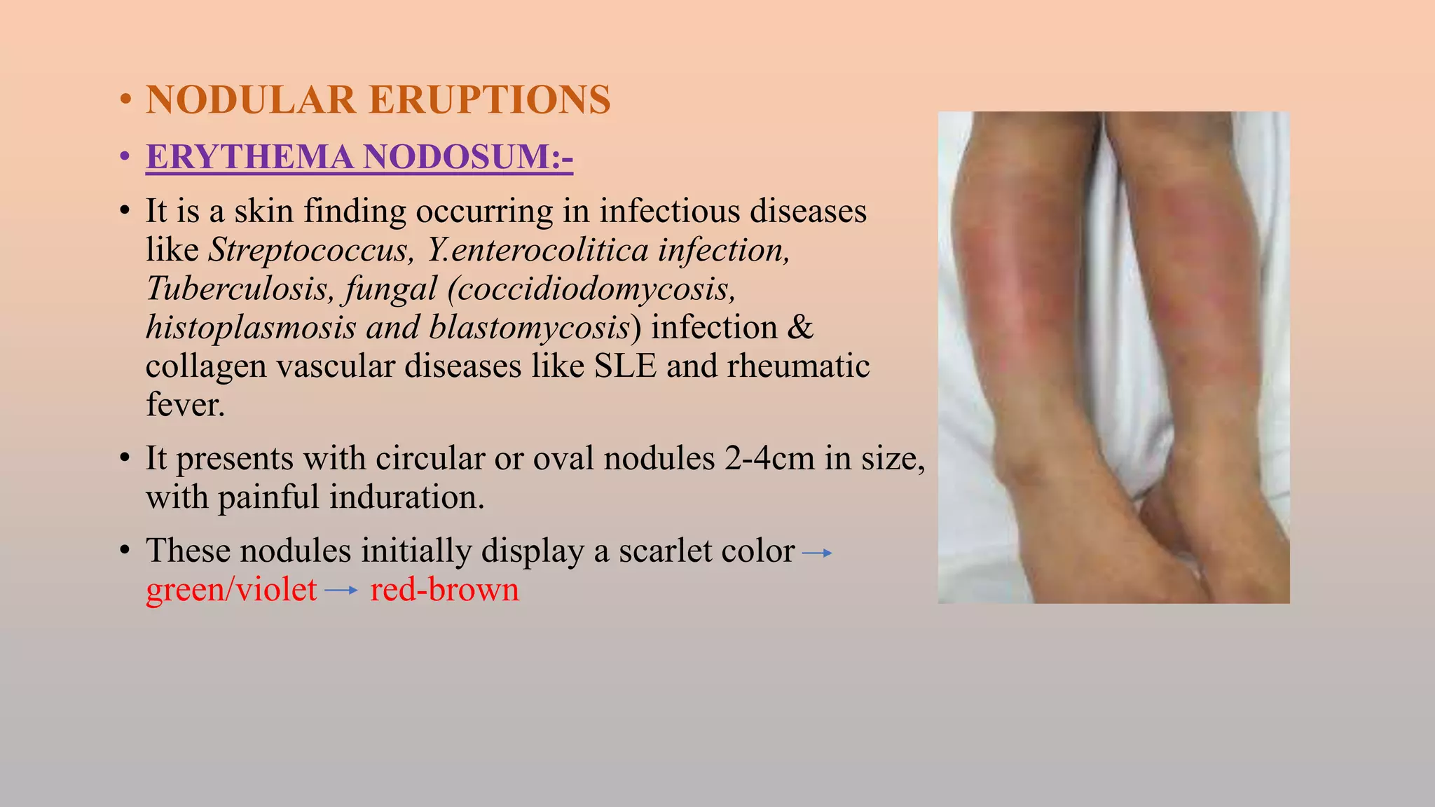 FEBRILE ILLNESS WITH SKIN RASHES.pptx