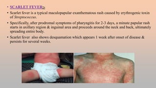 FEBRILE ILLNESS WITH SKIN RASHES.pptx