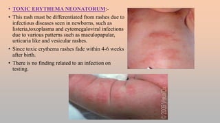 Nit Infection And Rash FEBRILE ILLNESS WITH SKIN RASHES.pptx