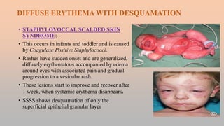 Diffuse Rash Pathology FEBRILE ILLNESS WITH SKIN RASHES.pptx