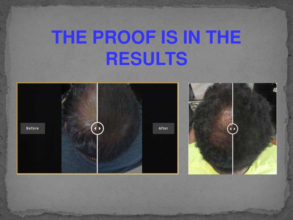 Febron Premium Fibers Solutions Most Effective Solutions