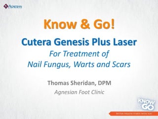 Know & Go!
Cutera Genesis Plus Laser
For Treatment of
Nail Fungus, Warts and Scars
Thomas Sheridan, DPM
Agnesian Foot Clinic

 