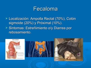 Fecaloma
   Localización: Ampolla Rectal (70%), Colón
    sigmoide (20%) y Próximal (10%).
   Sintomas: Estreñimiento o/y Diarrea por
    rebosamiento.
 