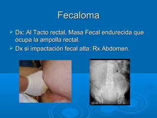 Fecaloma
   Dx: Al Tacto rectal, Masa Fecal endurecida que
    ocupa la ampolla rectal.
   Dx si impactación fecal alta: Rx Abdomen.
 