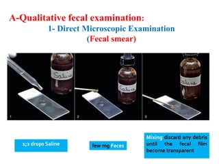 How to collect and examine fecal examination samples in veterinary ...