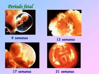 Período fetal
9 semanas 13 semanas
17 semanas 21 semanas
 