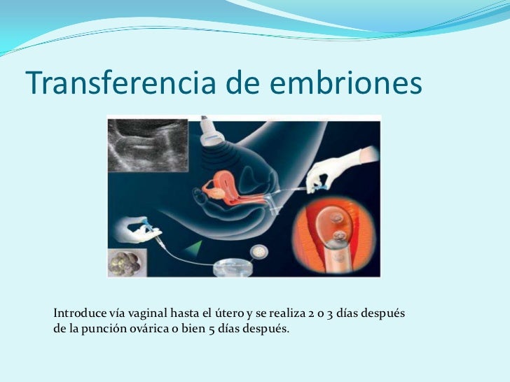 Muchos Gases Después De La Punción Ovárica Fecundaci..