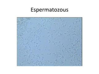 Espermatozous 