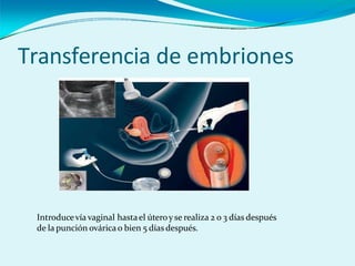 Transferencia de embriones
Introducevía vaginal hastael úteroy se realiza 2 o 3 días después
de la punción ovárica o bien 5 días después.
 