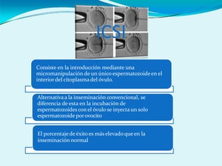 ICSI
Consiste en la introducción mediante una
micromanipulación de un único espermatozoideen el
interiordel citoplasma del óvulo.
Alternativaa la inseminación convencional, se
diferencia de esta en la incubación de
espermatozoides con el óvulo se inyecta un solo
espermatozoide porovocito
El porcentajede éxito es más elevado queen la
inseminación normal
 
