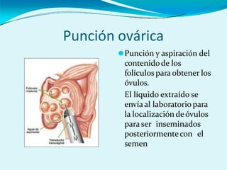Punción ovárica
⚫Punción y aspiración del
contenidode los
folículospara obtener los
óvulos.
El líquido extraído se
envíaal laboratorio para
la localización deóvulos
para ser inseminados
posteriormentecon el
semen
 