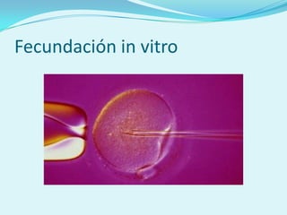 Fecundación in vitro
 