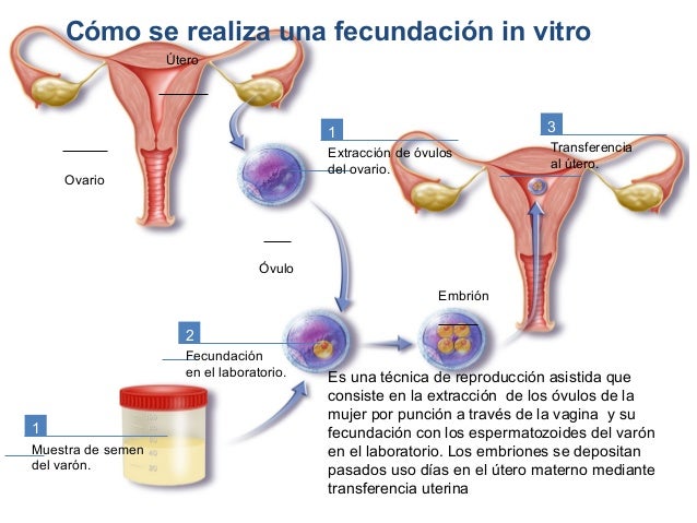 BIOETICA EN LA FECUNDACION IN VITRO