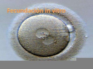 Fecundación in vitro 