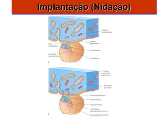 Implantação (Nidação)
 
