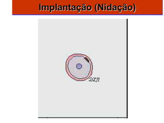 Implantação (Nidação)
 