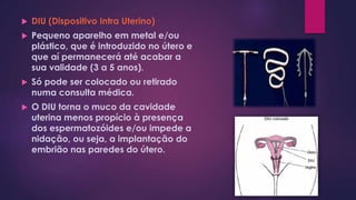  DIU (Dispositivo Intra Uterino)
 Pequeno aparelho em metal e/ou
plástico, que é introduzido no útero e
que aí permanecerá até acabar a
sua validade (3 a 5 anos).
 Só pode ser colocado ou retirado
numa consulta médica.
 O DIU torna o muco da cavidade
uterina menos propício à presença
dos espermatozóides e/ou impede a
nidação, ou seja, a implantação do
embrião nas paredes do útero.
 