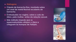  Diafragma
 Cúpula de borracha fina, montada sobre
um anel de metal flexível recoberto de
borracha.
 É introduzido na vagina, sobre o colo do
útero, pela mulher, antes da relação sexual.
 Este método impede que os
espermatozóides atinjam o útero e
cheguem às trompas de Falópio.
 